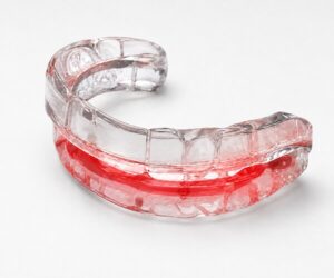 Oral Appliance Therapy